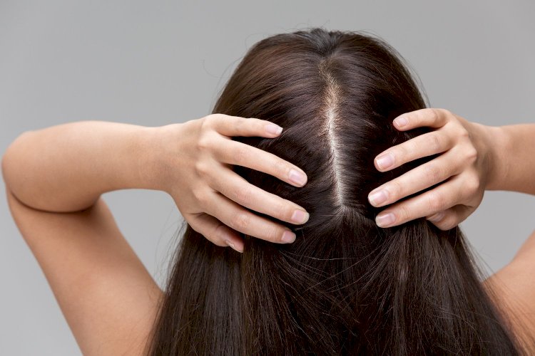 All About Hair Loss And Thinning: Here Are The Latest Treatments