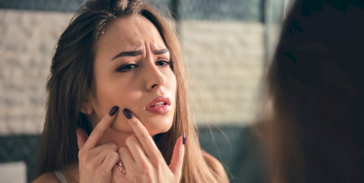 What Are The Reasons Behind Acne Striking Women After The Teen Years?