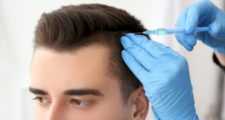 What To Look For In A Surgeon When You Go For Hair Transplant Surgery- Part 1 
