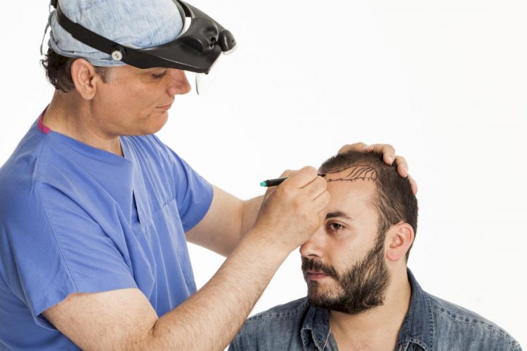 What Are The Surgeons' Credentials For Hair Transplant Surgery? – Part 1 