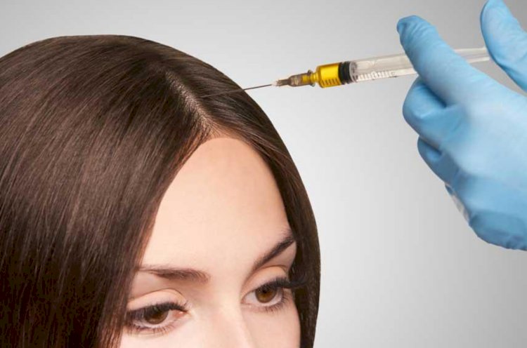 We Present Here PRP Treatment For Hair Growth As Well As Reduced Hair Loss – Part 3
